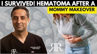 I Got a Mommy Makeover \u0026 This Is What Happened [HEMATOMA Complication]