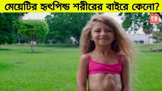 মেয়েটির হৃৎপিন্ড শরীরের বাইরে কেনো জানলে অবাক হবেন ।