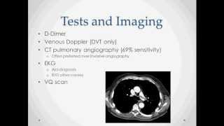 Pulmonary Embolism and DVT - USMLE Step 2 Review