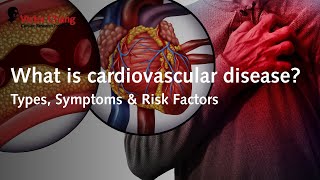 What is cardiovascular disease? | Victor Chang Cardiac Research Institute