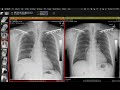 STR Cardiothoracic Case Webinar 8/18/2022