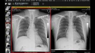 STR Cardiothoracic Case Webinar 8/18/2022