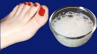 5 நிமிடத்தில் கருமையான பாதம் வெள்ளையாகிவிடும் | FOOT WHITENING IN 5 MINUTES