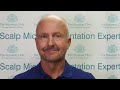 scalp micro pigmentation testimonial rob reviews the nouveau clinic