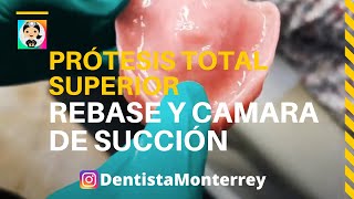 🤔❓Queda FLOJA 👉 SELLADO POSTERIOR Y CÁMARA de SUCCIÓN 👅 Prótesis Total Superior Parte6