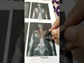 شرح عملي اناتومي upper limb بطريقه مبسطه جدا muscles عمرو_موسى