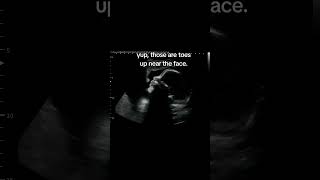 Baby toes up near the face on ultrasound at 26 Weeks 6 Days Pregnant! #soflexible #babyultrasound