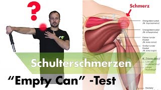 Schulterimpingement Testen |  Supraspinatussehne Entzündet?