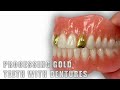 Processing Gold Teeth with Dentures