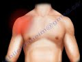 Clinical  examination of the  Shoulder, commonly used  shoulder tests