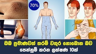 ඔබ ප්‍රමාණවත් තරම් වතුර නොබොන බව පෙන්නුම් කරන ලක්ෂණ 10ක් | 10 Signs You're Not Drinking Enough Water