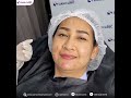 made collagen ล้างพิษผิว ขาวใส เรียบเนียน สยามคลินิก siam clinic คลินิกความงาม