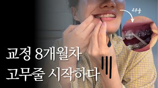 치아 교정 8개월차 고무줄 시작하다🥹 _ 치아 교정 고무줄 착용법에 들어간 데이트 한방울 브이로그