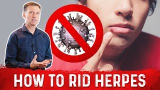 How To Get Rid Herpes Virus with Autophagy Fasting? - Dr. Berg