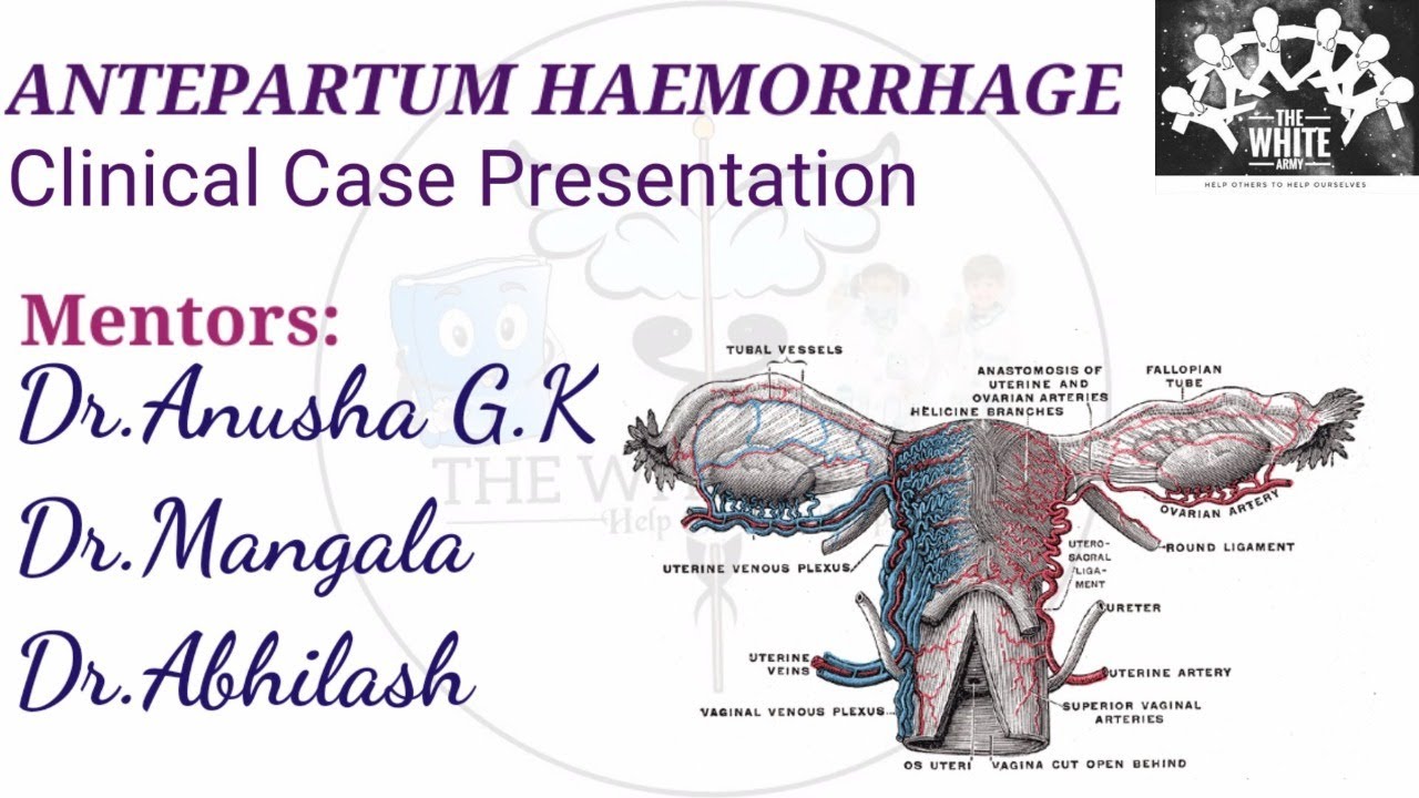 Antepartum Heamorrhage Clinical Case Presentation Youtube Antepartum Heamorrhage Clinical Case Presentation Youtube