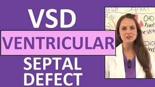 Ventricular Septal Defect Nursing | NCLEX Pediatric Congenital Heart Defects