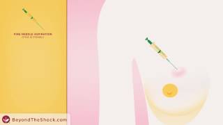 Beyond The Shock - Chapter 4 - Diagnosis - Biopsy