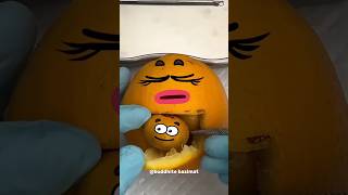 কমলার ডেলিভারি | Orange Surgery #shorts #youtubeshorts #viral #short #funny