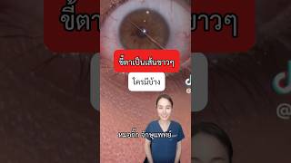 ขี้ตาเป็นเส้นขาวๆ #หมอกิ๊ก #จักษุแพทย์ #ophthalmologist #mucusfishingsyndrome #ขี้ตา #ตาอักเสบ