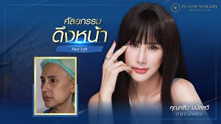 ผลลัพธ์ 2 เดือน หลังดึงหน้า  ‼ “หลังดึงหน้า มีแต่คนชมว่าดูเด็ก ตรงปก ชอบมากค่ะ ”