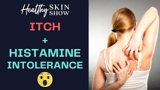 Itchiness + Histamine Intolerance - WHY Am I ITCHY? | Jennifer Fugo