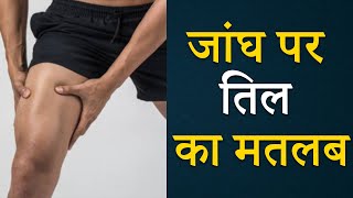 जांघ पर तिल का मतलब | The Meaning of Mole on the Thigh