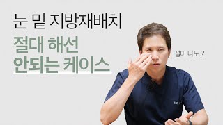 이런 분들은 눈밑지방재배치를 피해주세요!