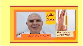 تحليل الإيدز و حرقة البول | HIV test