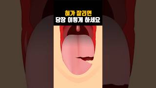 혀가 잘리면 당장 이렇게 하세요