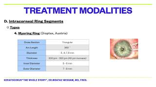 IntraCorneal Ring Segments (ICRS) Part 1 by Dr.Moataz Wessam