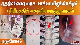 ஆத்தி எவ்வளவு பெருசு.. ஊசியை விழுங்கிய சிறுமி.. 3 நிமிடத்தில் அகற்றிய மருத்துவர்கள் - முழு விளக்கம்