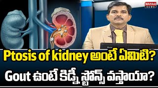 Ptosis of kidney అంటే ఏమిటి? Gout ఉంటే కిడ్నీ స్టోన్స్‌ వస్తాయా? | Dr Kammela Sreedhar | Mahaa News