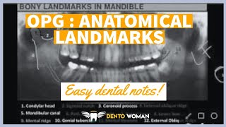 OPG ( orthopantomogram ) :  NORMAL ANATOMICAL LANDMARKS #easydentistry #easydentalnotes #opg