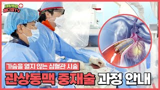 [인천심장내과] 가슴을 열지 않는 심혈관 시술, 관상동맥 중재술 과정 모두 알려드립니다.