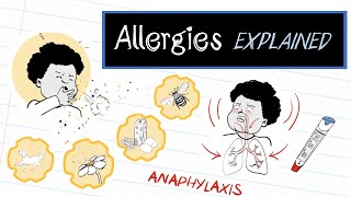 What are Allergies? (HealthSketch)