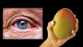 Unbelievable!🔥 I have 100% restored my vision! Effective drink for vision