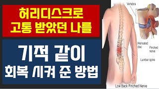 죽을 것 같은 허리디스크에 의한 좌골신경통 | 확 줄여드리겠습니다.