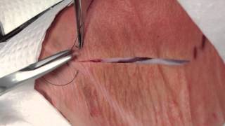 Running Percutaneous Sutures