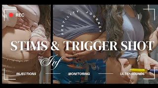 IVF Stims \u0026 Starting Trigger Shot  | CNY FERTILITY | IVF | FERTILITY JOURNEY | IVF COUPLE