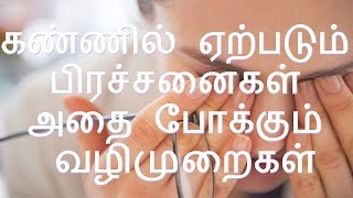 கண்ணில் ஏற்படும் பிரச்சனைகள் அதை போக்கும் வழிமுறைகள்