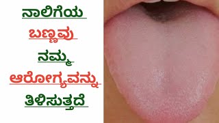 #youtube ನಾಲಿಗೆಯ ಬಣ್ಣವು ನಮ್ಮ ಆರೋಗ್ಯವನ್ನು ತಿಳಿಸುತ್ತದೆ#helthtips