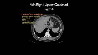 Pain Right Upper Quadrant Part 4 #radiology #radiologist #cirrhosis #hepatic #hcc