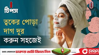 ত্বকের রোদে পোড়া দাগ দূর করার ৭টি ঘরোয়া উপায় | Skin Care | I Tips |  Independent TV