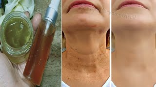 Anti aging magic oil,  This oil will erase all the wrinkles on your face, stronger than Botox