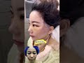 过年四件套 整形 医美 facelift plastic 拉皮 glowup