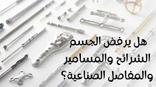 هل يلفظ الجسم الشرائح والمسامير أو المفاصل الصناعية؟