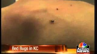 Bed bugs creeping up everywhere in KC