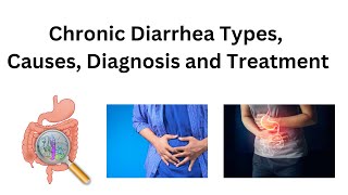 Chronic Diarrhea Types, Causes, Diagnosis and Treatment