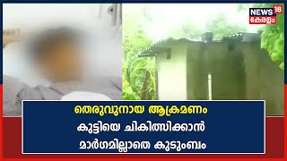 തെരുവുനായ ആക്രമണത്തിൽ കുട്ടിക്ക് ചലനശേഷി നഷ്ടപ്പെട്ട സംഭവം ; ചികിത്സിക്കാൻ മാർഗമില്ലാതെ കുടുംബം