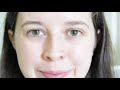 skin essence organics review to cure sensitive dry skin *before u0026 after*